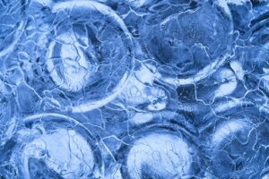 生理前にワキガが悪化する原因と対策は？